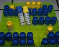 production de kits Elisa pour les principaux virus