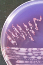 Colonies bacteriennes